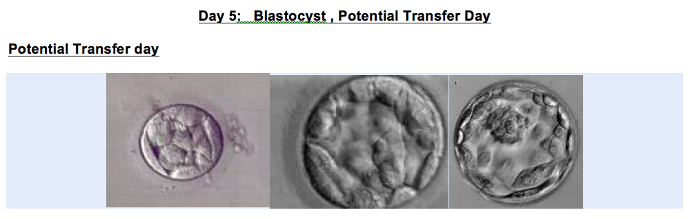 What Goes On Behind the Closed Doors of the IVF Laboratory | WIN